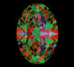 5.51ct Oval L VS2 Natural Diamond ASET image