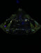 4.03ct Round I VS2 Natural Diamond fluorescence image